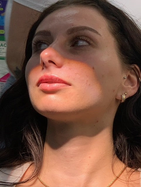 Why Pain-Free Cosmetic Injections Matter More Than Ever By Dr Frances, at Faces by Dr Frances Clinic